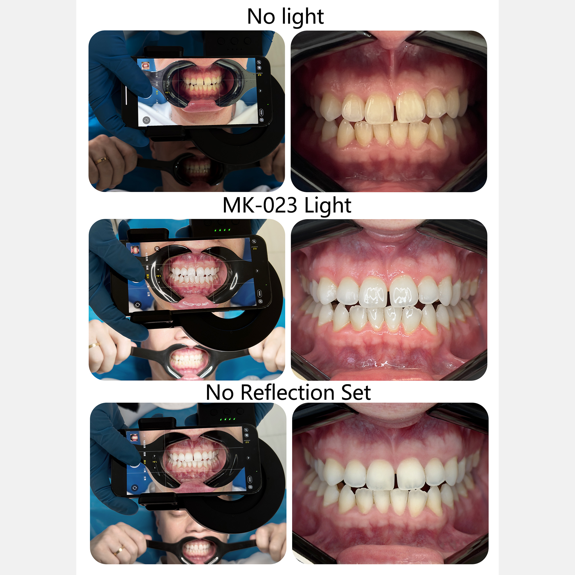 HERA MK-23 Intraoral Dental Ph - огляд і ціна Photography Lighting Ring